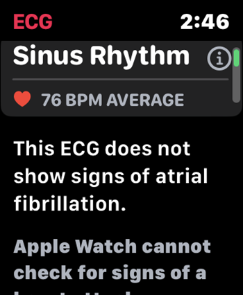 ECG app findings