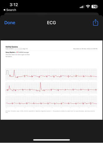 ECG report PDF