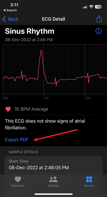 Export ECG report as PDF